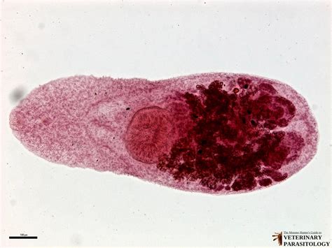  Heterophyes heterophyes：這個寄生蟲究竟是怎麼在你的腸道中安家立命？