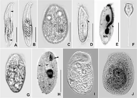  Litonotus，The Tiny Tentacle Dancer! A Glimpse into the Fascinating World of These Ciliated Protists